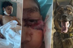 Police Dog Brutally Attacks 13-Year-Old Boy, Rips Off His Face in Australia Allegedly in Break-In Case; Family Demands Justice