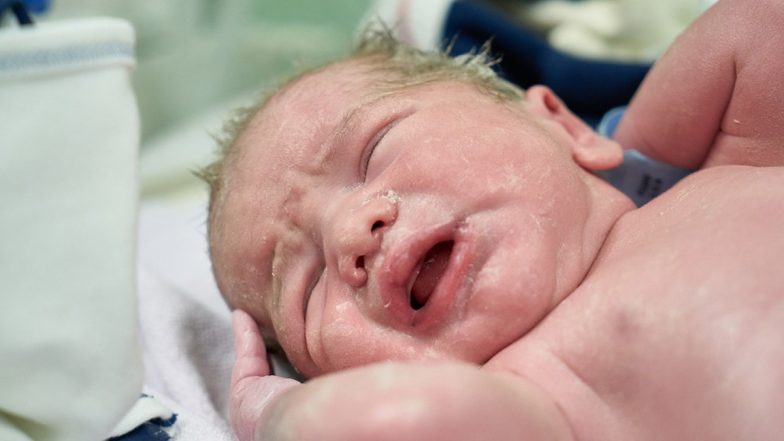 Baby Girl Born With Extremely Rare 2-Inch-Long ‘True Tail’ Covered in Hair and Skin in Northeastern Mexico (View Tweet)