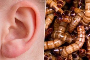Flesh-Eating Maggots Found Living in Man's Ear Canal, Gets Hospitalised As The Infested Larvae Cause Pain & Bleeding (Watch Video)