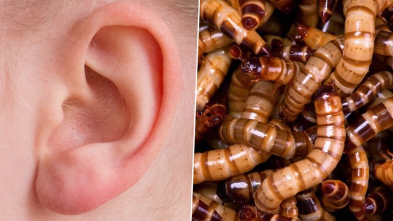 Flesh-Eating Maggots Found Living in Man’s Ear Canal, Gets Hospitalised As The Infested Larvae Cause Pain & Bleeding (Watch Video)