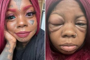 Woman Tattoos Her Eyeballs Purple and Blue! Northern Ireland-Based Woman Says She Might Be Losing Her Eyesight, Should Have Listened to Daughter (View Tweet)