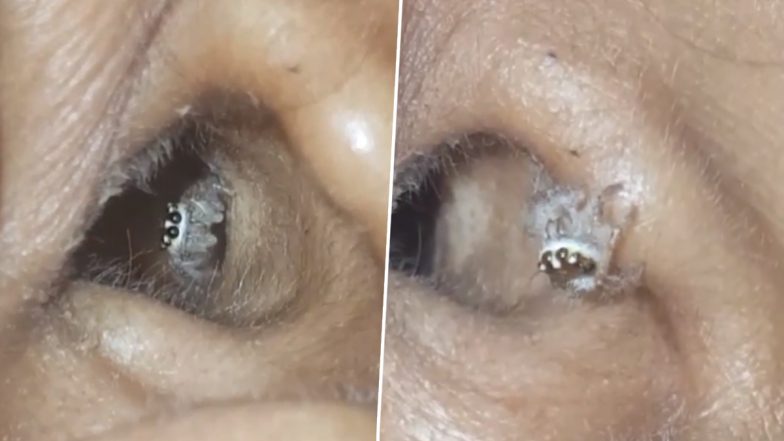 Spider Crawls Out of Woman’s Ear in Viral Video; Netizens Appalled and Impressed by Its Skills