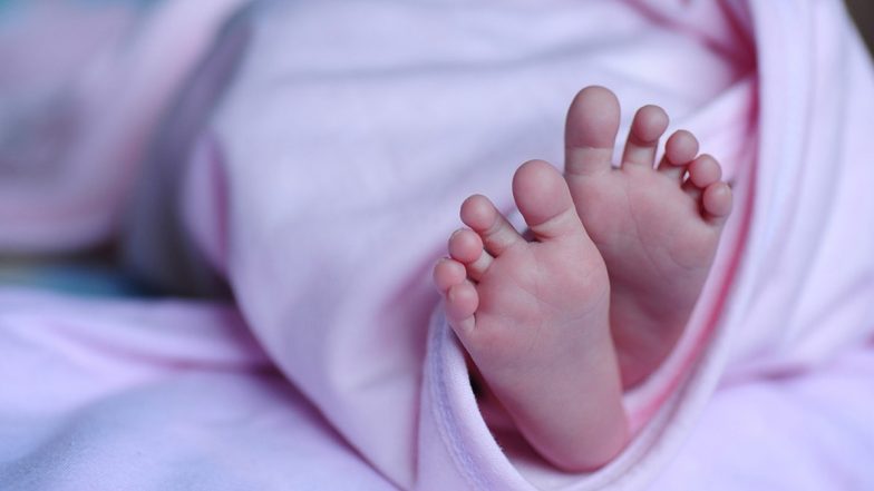 Uttar Pradesh: Baby Born With Giant Congenital Melanocytic Nevus in Hardoi, Newborn Covered With 60% Hair on Back (See Pic)
